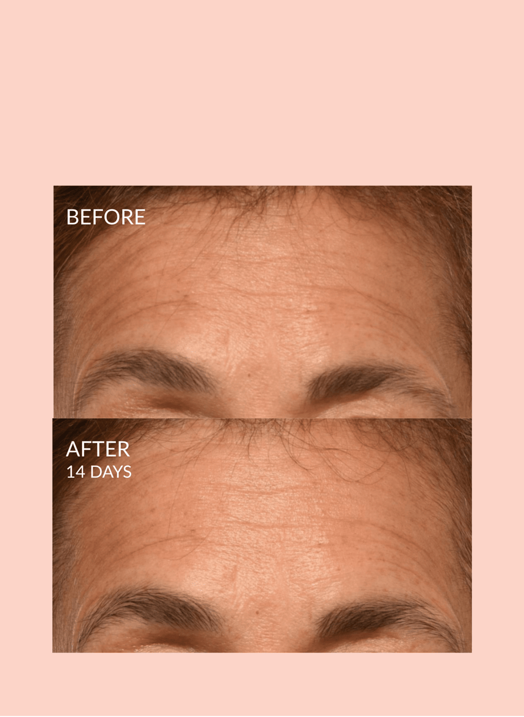 Triple Lift Molecule Mask